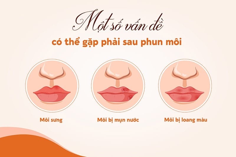 Một số vấn đề thường gặp sau khi phun xăm