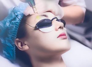 hình ảnh sau khi xóa xăm lông mày bằng laser